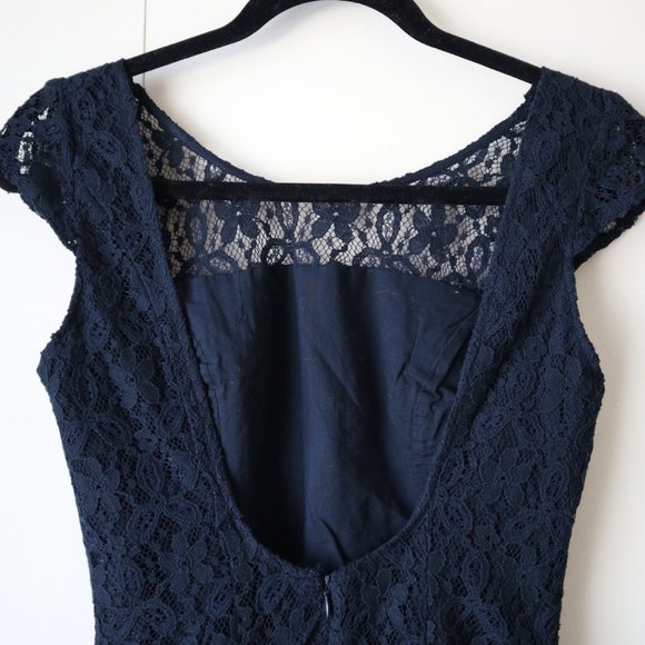 Hollister Navy Blue Lace Mini Dress - Picture 3 of 8